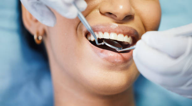 Best Emergency Tooth Extraction  in Camp Swift, TX